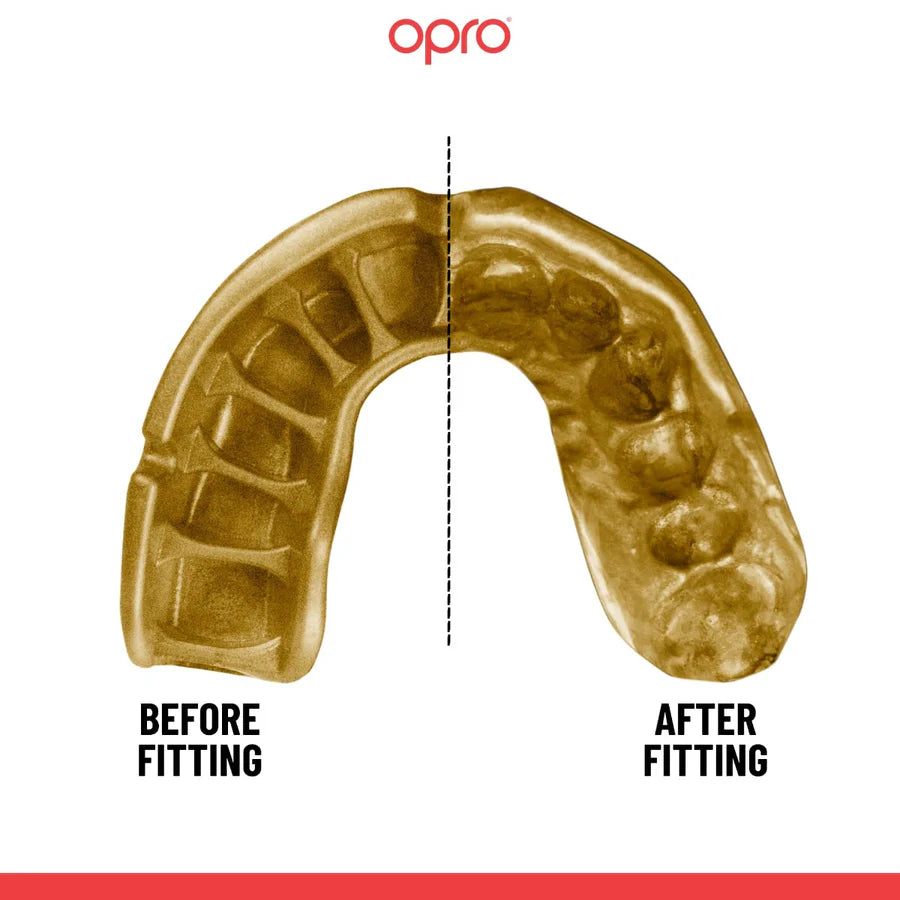 OPRO UFC GOLD Black Metal/Gold - Premium Gebitsbeschermer