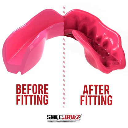 SAFEJAWZ Roze Fluid Fit Bitje – INTRO PINK